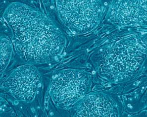 Embryonic stem cell research is constantly under ethical and moral debate