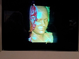 3D holographic representation of a brain scan