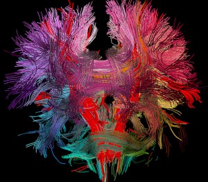 Neural Connections in the Human Brain (image by Image Editor, Flickr, CC)